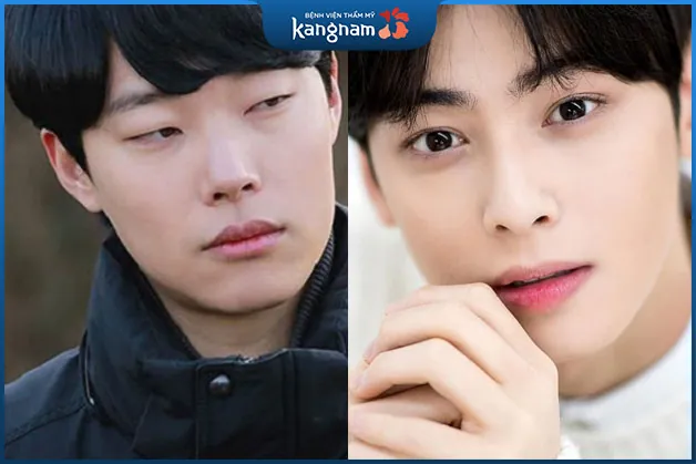 Hình ảnh so sánh mắt 1 mí và 2 mí.