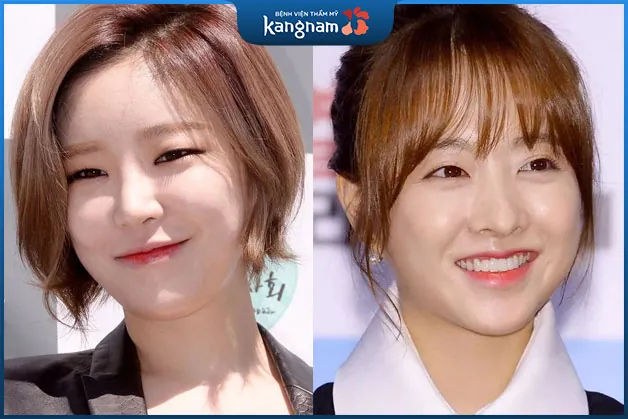 Tóc ngắn mái chéo hoặc tóc mái thưa đều phù hợp với người mắt 1 mí