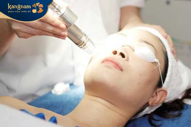 Sử dụng công nghệ Laser cũ