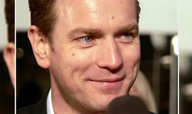 Nốt ruồi ở giữa trán đàn ông có ý nghĩa gì?