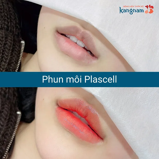 Kết quả khách hàng phun môi tại Kangnam