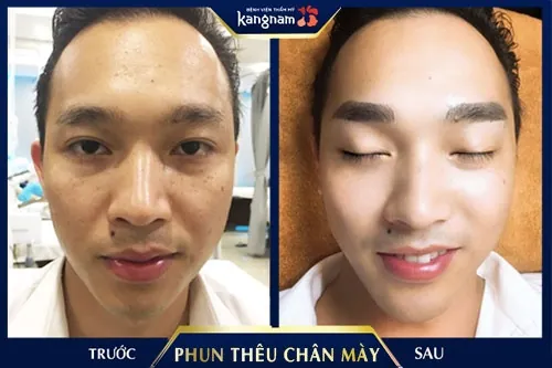 phun thêu chân mày