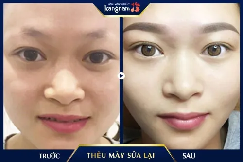 thêu lông mày bị hỏng