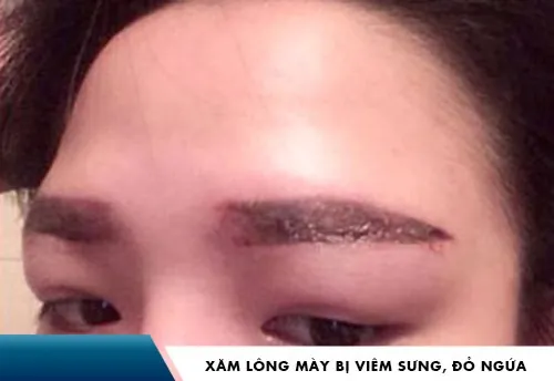 xăm lông mày lỗi