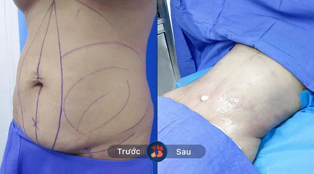 Eo trở nên thon gọn và đẹp, không còn béo như trước