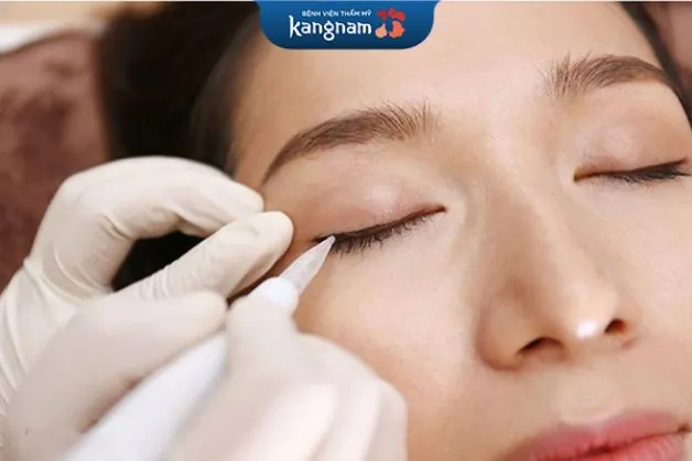 Công nghệ phun mí mở tròng Hàn Quốc