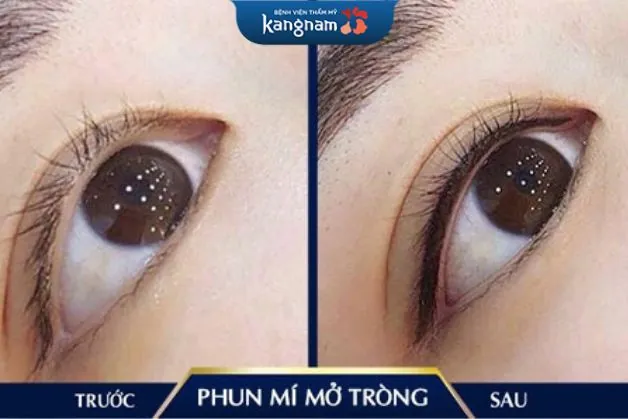 Mí rõ ràng, sắc nét cho đôi mắt to hơn