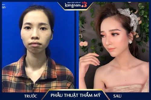 95 sao hàn phẫu thuật thẩm mỹ