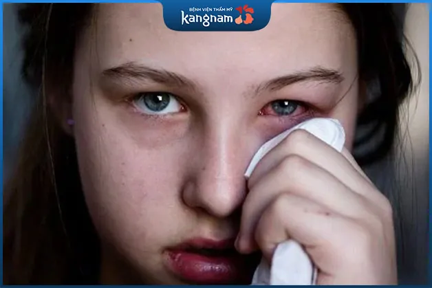 Việc dùng mỹ phẩm, kem dưỡng mắt không rõ nguồn gốc có thể gây hại cho mắt