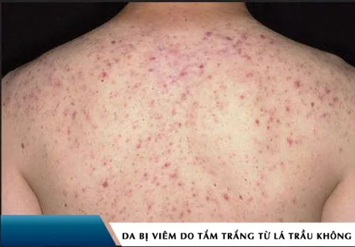 cách làm đẹp với lá trầu không