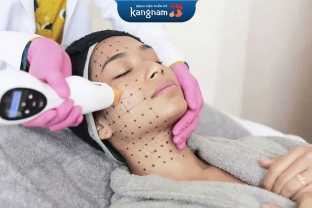 Cơ chế hoạt động của công nghệ trẻ hóa da Thermage FLX đặc biệt thông minh, phân biệt được từng phân vùng cần tác động sóng Cơ chế hoạt động Thermage FLX
