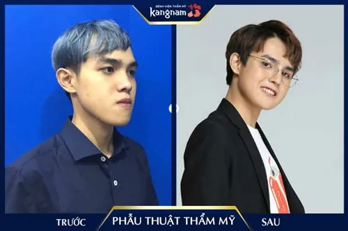 có nên phẫu thuật thẩm mỹ không