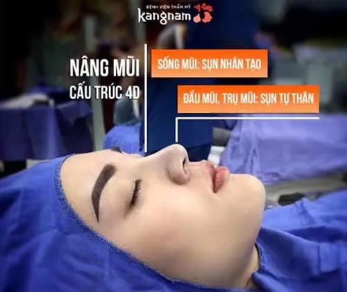 diễn viên nam trung quốc phẫu thuật thẩm mỹ