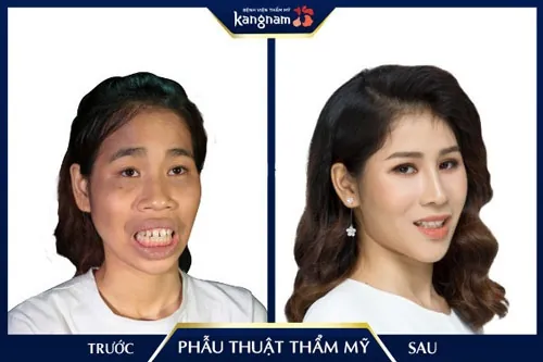 những ca phẫu thuật thẩm mỹ thành công