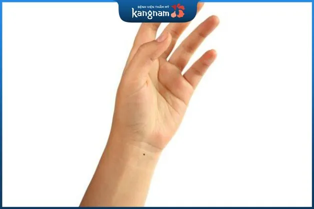 Nốt ruồi mọc ở cổ tay trái nữ cho thấy là người nhạy bén