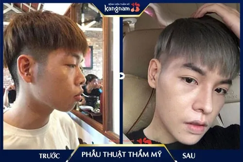 phẫu thuật thẩm mỹ