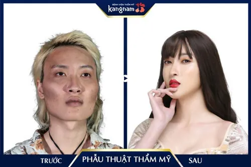 phẫu thuật thẩm mỹ hết bao nhiêu tiền