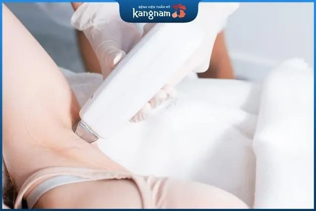 Tẩy nốt ruồi trên nách bằng công nghệ cao