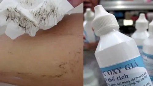 Không nên để oxy già trên da trong thời gian dài dễ dẫn tới kích ứng, mẩn đỏ, không tốt cho da triệt lông bằng oxy già