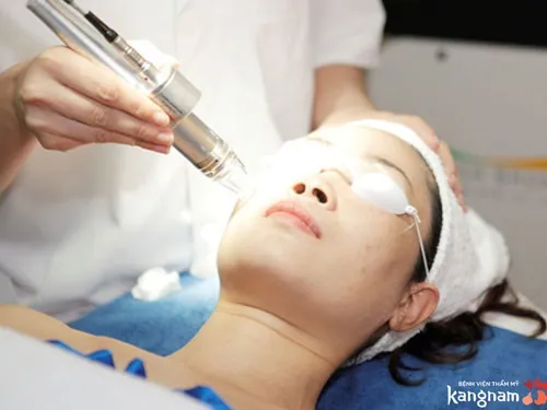 Hiệu quả sau điều trị sẹo bằng công nghệ ánh sáng lên tới 90%