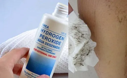 Oxy già có khả năng tác động vào nang lông khiến chúng suy yếu, đứt gãy khỏi bề mặt da triệt lông nách bằng oxy già