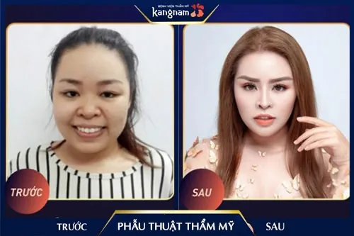 ưu điểm của phẫu thuật thẩm mỹ