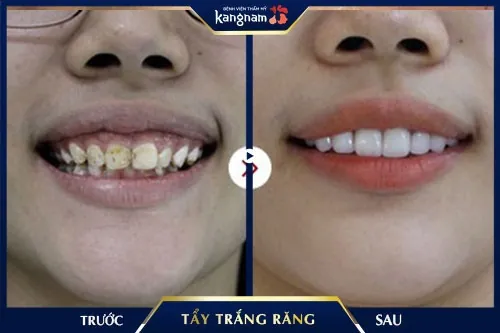 bột than tre trắng răng bột than tre trắng răng