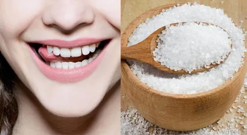 cách lấy cao răng tại nhà bằng muối