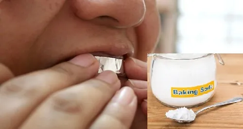 cách tẩy trắng răng bằng baking soda