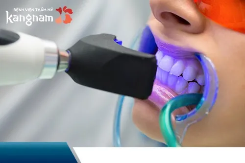 có nên tẩy trắng răng