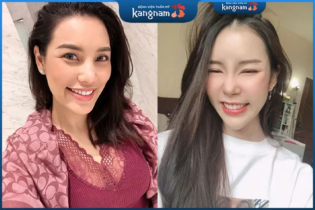 Chị Linh cười thích thú với hàm răng trắng sáng