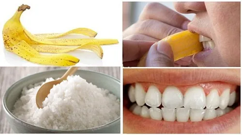 lấy cao răng bằng muối