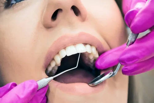 bảng giá cạo vôi răng