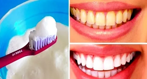 lấy cao răng tại nhà bằng muối