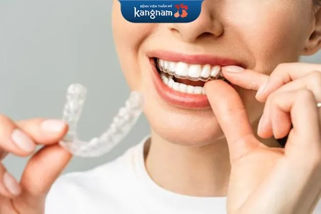 Sử dụng máng tẩy trẳng răng tại nhà