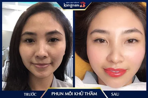 mật ong có trị thâm môi không