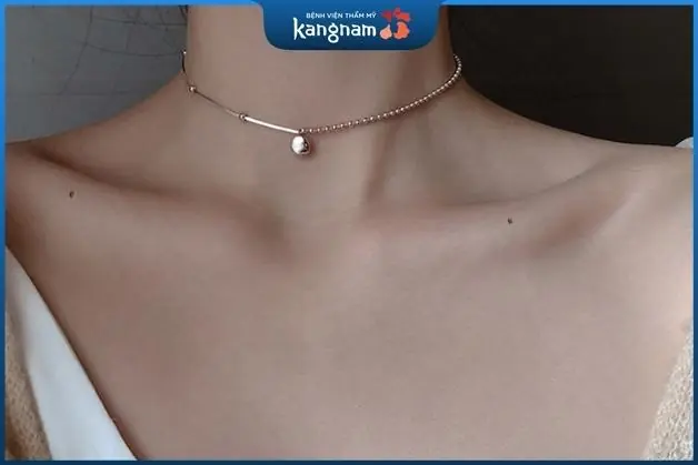 Nốt ruồi ở 2 bên xương quai xanh