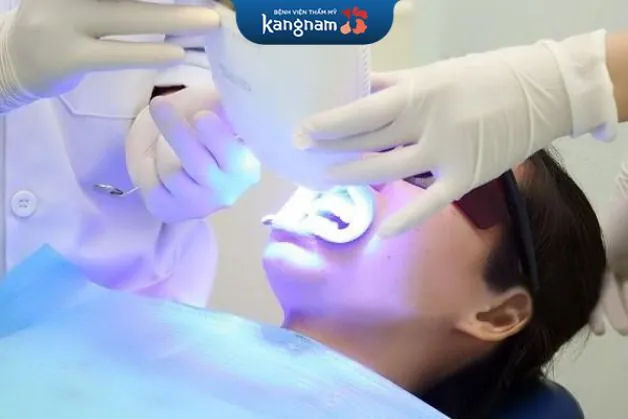 Có nên tẩy trăng răng không