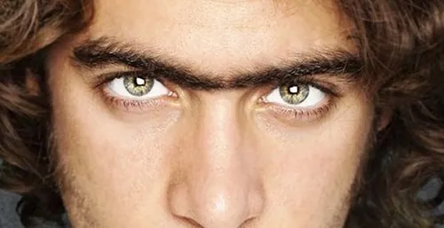 Lông mày mọc lan sang vị trí ấn đường gây ảnh hưởng đến thẩm mỹ