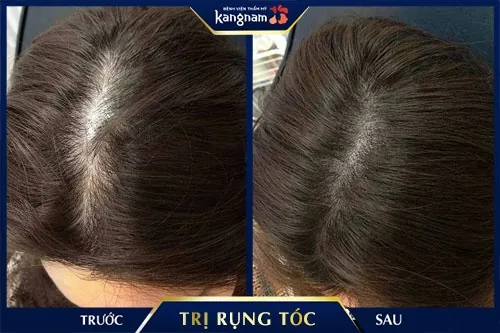 gội đầu bằng bồ kết có tốt không