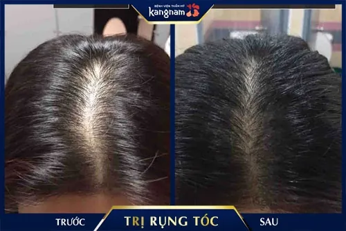 gội đầu bằng bồ kết đúng cách