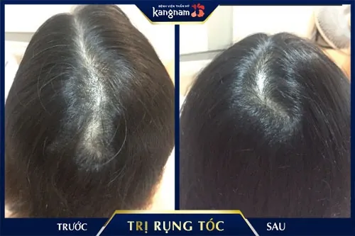 gội đầu bằng bồ kết sau sinh