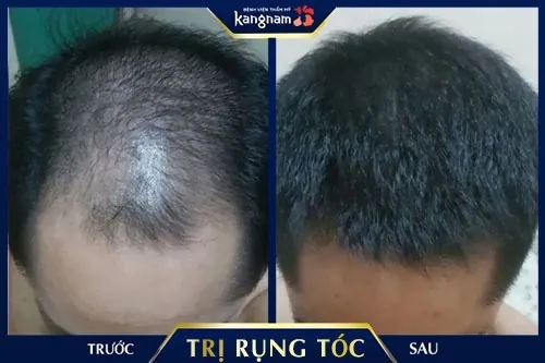 gội đầu bằng bồ kết lá sả gội đầu bằng bồ kết lá sả