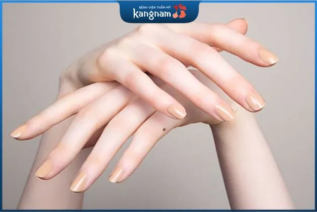 Ý nghĩa nốt ruồi ở ngón tay út