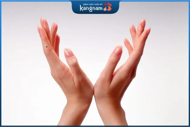 Nốt ruồi ngón tay xấu hay tốt tùy thuộc vào nhiều yếu tố