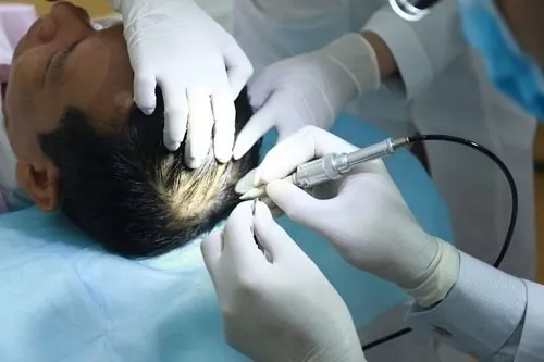 giảm rụng tóc sau sinh