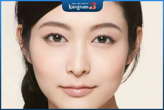 Nốt ruồi ở lông mày