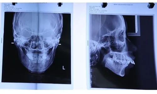 khám sức khỏe chụp xương nguyễn thị huê