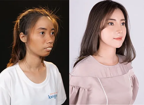 hành trình lột xác mùa 4 nguyễn thị huê hành trình lột xác mùa 4 nguyễn thị huê