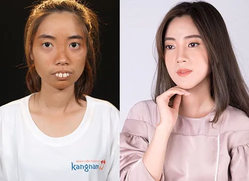 nguyễn thị huê hành trình lột xác tại kangnam nguyễn thị huê hành trình lột xác tại kangnam